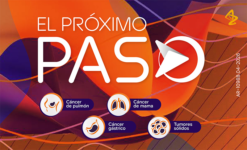 El próximo paso